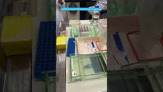 Agarose Gel Electrophoresis electrophoresis DNA analysisofnucleicacid molecularbiology [upl. by Flory]