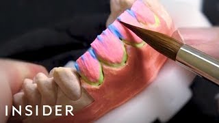 How This Dentist Crafts 80000 Veneers For Celebrities  Beauty Explorers [upl. by Glover]