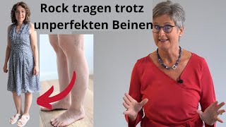 Bein zeigen trotz Besenreiser Venen…5 praktische Tipps [upl. by Anirehtak71]