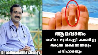 ഈ ലക്ഷണം നിങ്ങൾക്കുണ്ടോ ശ്രദ്ധിക്കുക Dr Padmanabha shenoy RheumatismBaijus Vlogs [upl. by Yanahs]