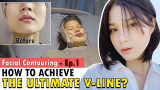 SUB Ultimate VLine Face  Facial Bone Contouring Surgery in Korea  Cheekbone amp Jawline Reduction [upl. by Mita]