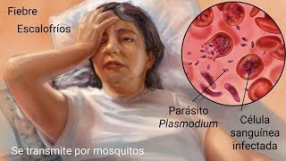 Que es el Paludismo o la Malaria Síntomas Diagnóstico Tratamiento y Prevención [upl. by Elsa]