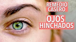 COMO QUITAR LOS OJOS HINCHADOS OJERAS Y BOLSAS EN LOS OJOS  YASMANY [upl. by Eadie]