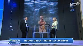 Noduli della tiroide cosa sono La diagnosi Lintervento mini invasivo [upl. by Ahcila]