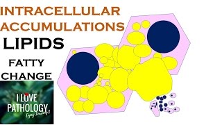 INTRACELLULAR ACCUMULATIONS LIPIDS Fatty Change [upl. by Mollee]