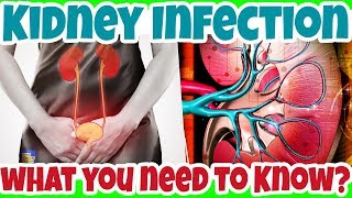 What You NEED to KNOW about KIDNEY INFECTION A Serious UTI Condition  Pyelonephritis [upl. by Ykcin]