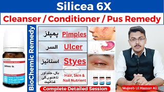 Silicea 6x Homeopathic Medicine Benefits  Silicea Homeopathic Medicine  Silicea [upl. by Ahker]