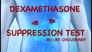 DEXAMETHASONE SUPPRESSION TEST CUSHING DISEASE  CUSHING SYNDROME  DEXAMETHASONE STRESS TEST [upl. by Itra815]