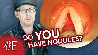 Do I Have Nodules  Nodes on Vocal Cords  DrDan 🎤 [upl. by Peednama408]