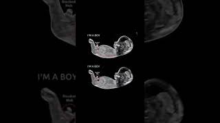 Embryo and Fetal Development In Mothers Womb 🥰 For medical knowledge purpose [upl. by Meeker]