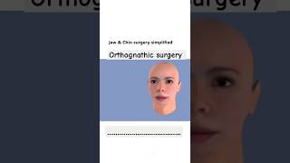 Orthognathic surgery shorts cristiano mbbs femalereproductivesystem [upl. by Htieh]