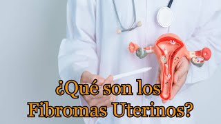 ¿Qué son los Fibromas Uterinos [upl. by Hillie]