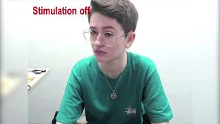 Watch as tiny shocks ‘turn off’ Tourette Syndrome tics [upl. by Salazar]