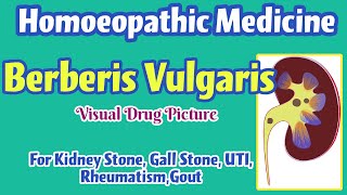 Berberis Vulgaris Homoeopathic Medicine Uses  Symptoms  Renal Stone Gall Stone Renal Colic [upl. by Gnehp]