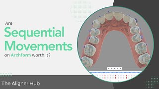 Sequential Movements on Archform [upl. by Dnalkrik282]