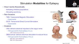 IEEE BioCAS 2023 Tutorial  ClosedLoop Neurostimulators for PatientOptimized Treatment of Epilepsy [upl. by Ilyah504]