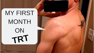 My First Month on TRT  Testosterone Replacement Therapy [upl. by Agem]