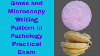 Writing pattern of Microscopy and Gross features in Pathology Practical Exam Approach to Patho OSPE [upl. by Enrak]