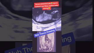 Baby Abdominal pain due to mother wrong sleep position😭viralvideo trending viralshorts [upl. by Ordway]