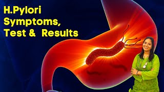 HPylori Test in Hindi  Symptoms Test and Results in Hindi [upl. by Embry]