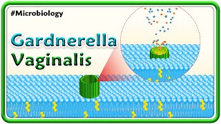 Gardnerella Vaginalis  Microbiology USMLE Step 1 [upl. by Joby]