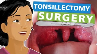 Tonsillectomy Surgery [upl. by Airod]