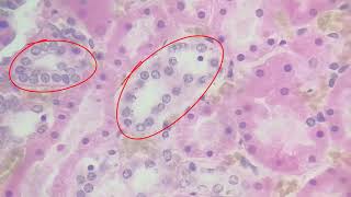 simple cuboidal epithelium [upl. by Hike]