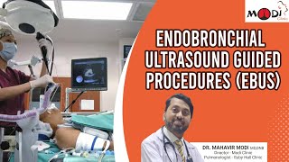 Exploring EBUS Unlocking the Potential of Endobronchial UltrasoundGuided Procedures [upl. by Eirrahs]