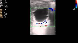 Color Doppler Ultrasound of a 20 day equine pregnancy [upl. by Tak]