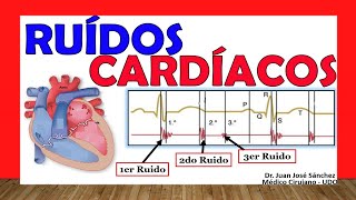 🥇 RUIDOS CARDÍACOS R1 R2 R3 y R4 ¡Fácil Explicación [upl. by Gebelein747]