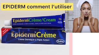 EPIDERM Crème 🥰comment l’utiliser [upl. by Ebarta]