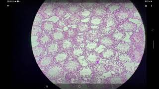 Testis  Histology slide identification and explanation [upl. by Dulcea2]