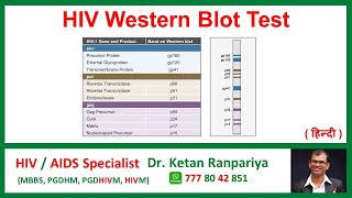 Understanding the HIV Western Blot Test Accuracy Results amp What it Means for You [upl. by Nonahs]