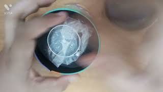 Fastrack watch unboxing [upl. by Unders]