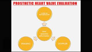 Prosthetic valve 2 [upl. by Agn]