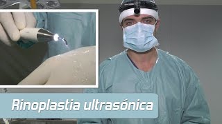 ¿Cuánto tiempo dura la recuperación de una Rinoplastia I Recuperación de Rinoplastia I Cirugía [upl. by Esile91]