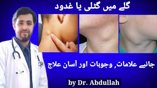 Swollen Lymph Nodes In Neck Symptoms Causes amp Treatment  Lymphadenopathy  Gale Ki Gilti Ya Ganth [upl. by Schonthal]