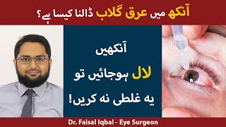 Eye Redness Ka Ilaj  Red Eyes Causes  Red Eye Infection Treatment  Aankhon Ka Laal Ho Jana [upl. by Hebert294]