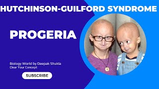 Progeria  Progeria disease  progeria  progeriasyndrome  Hutchinson Guilford Syndrome [upl. by Fahey]