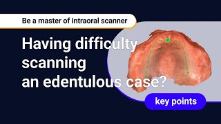 Mastering Intraloral Scanners  Edentulous scanning [upl. by Nannie]