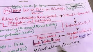 Rhabdomyolysis USMLE Step 1  Renal Pathology [upl. by Ronoh]