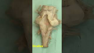 Facial colliculus Rhomboid fossa neuroanatomy brain brainstemrhomboidfossa [upl. by Hsirahc898]