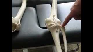 Part 1 Type 2 Cuboid Syndrome  Hesch Method Physical Therapy [upl. by Freddi]