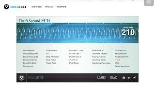 How to perform ACLS  Advanced Cardiac Life support [upl. by Aksoyn]