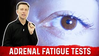 Two Simple Tests for Adrenal Fatigue – DrBerg [upl. by Kella426]