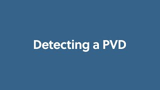 Detecting a PVD [upl. by Abram]