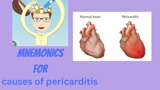 MNEMONICS for causes of pericarditis [upl. by Oalsinatse]