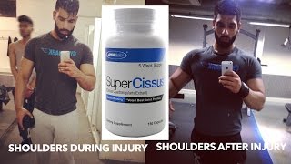 The Supplement That Fixed My Shoulder Injury Super Cissus Review [upl. by Kaczer129]