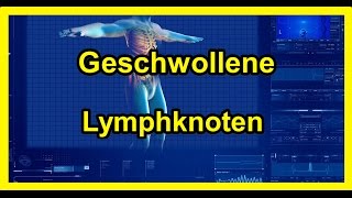 Geschwollene Lymphknoten  Vergrößerte Lymphknoten 2020 [upl. by Airak93]