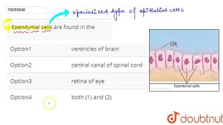 Ependymal cells are found in the [upl. by Absa]